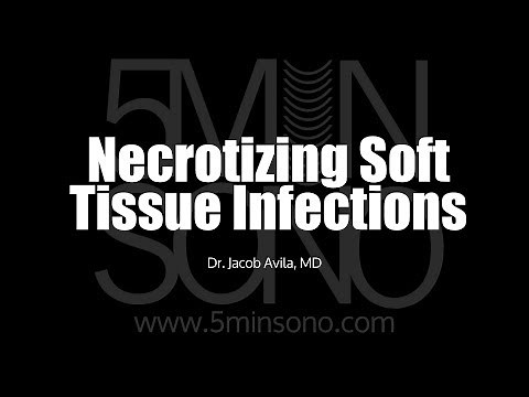 Necrotizing Soft Tissue Infection
