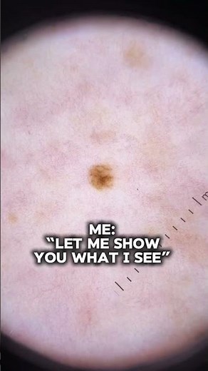 During a skin cancer screening exam, I hear this frequently from patients