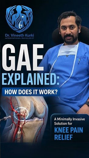 GAE Explained: How Does It Work? | Dr Vineeth Kurki