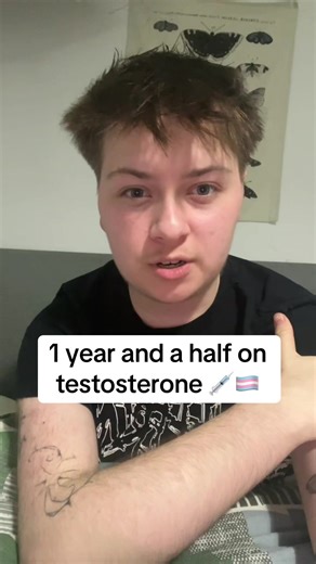 1.5 Years on Testosterone: My Transition Journey