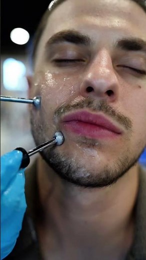 TOP 5 Benefits of Microcurrent Therapy ⚡