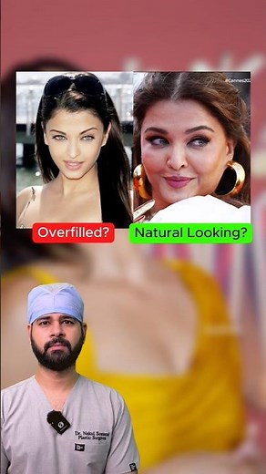 Natural Looking Filler & Botox vs Overfilled ft. Bollywood Celebs. by Dr. Nakul Somani