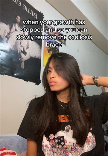 Coping with Scoliosis: Milwaukee Brace Insights