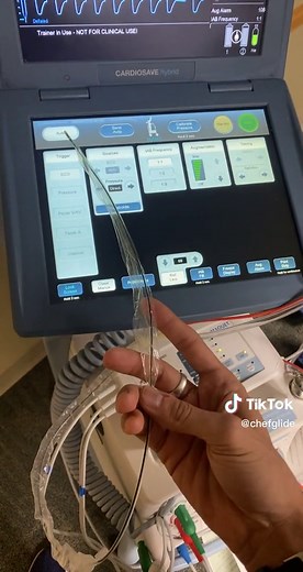 Balloon Pumps #helium #IABP #perfusionist #cvicu #cvicurn Augmentation during diastole increases coronary perfusion pressure and decreases systemic resistance during deflation. The primary goal of intra-aortic balloon pump (IABP) treatment is to increase myocardial oxygen supply and decrease myocardial oxygen demand. Decreased urine output after the insertion of IABP can occur because of juxta-renal balloon positioning. Haemolysis from mechanical damage to red blood cells can reduce the haematoc