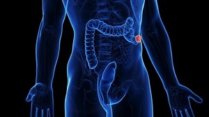 3d Rendered Medical Animation Colectomy Stock Footage Video (100% Royalty-free) 1096169665 | Shutterstock