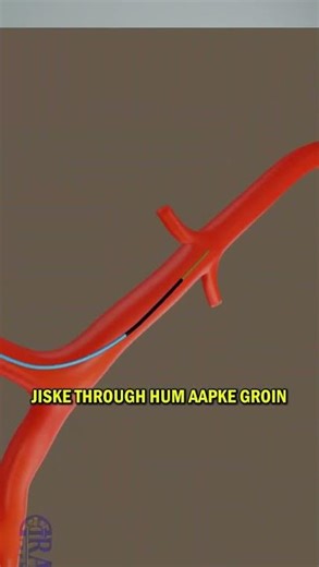 Gentlemen, let's talk about those midnight bathroom trips.