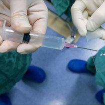 Video: Clinical Application of 24 G Cannula Needle and 3-0 Polypropylene Suture in Vas Deferens Exploration