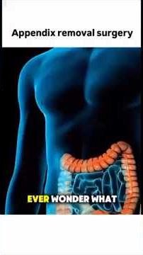 Appendix Removal Surgery ✨💥 #ytshorts #medicalprocedure #surgeryeducation #newvideo