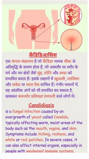 कैंडिडा संक्रमण: मुंह, योनि और त्वचा पर प्रभाव Candida Infection: Effects On The Mouth|Vagina|Skin