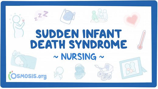 Sudden infant death syndrome (SIDS): Nursing: Video & Causes | Osmosis