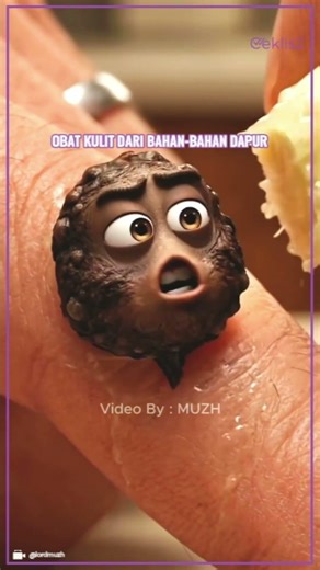 Masalah Kulit ‘Protes’ 😂 Cuma Gara-Gara Bahan Dapur! #Shorts