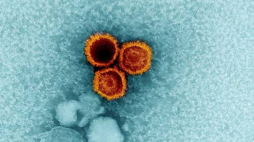 Scientists Say Epstein-Barr Virus May Trigger Lupus Disease