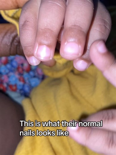 Understanding the Risks of Razor Blades for Nail Care