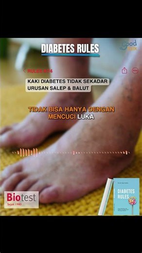 DIABETES RULES #74 - Diabetic FEET Are Not Just About Ointments & Bandages #youtubehealthindonesia