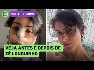 Zé Longuinho shows first results of facial feminization; SEE