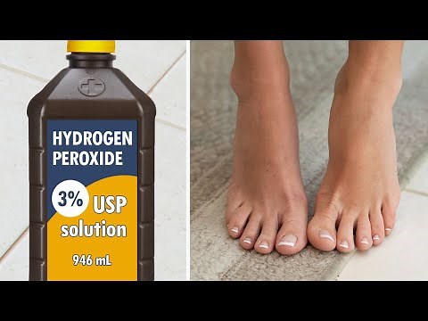 Put Hydrogen Peroxide on Your FEET - The Results Will SHOCK You