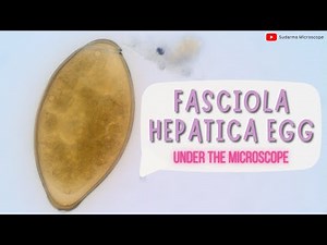 Fasciola hepatica egg under the microscope