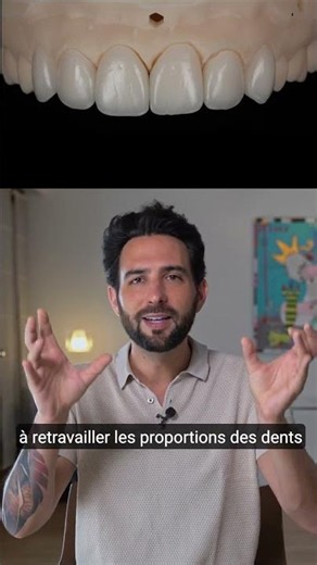 3 HISTOIRE DE SOURIRES (Diastème & Alignement)