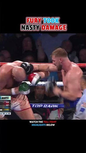 Tyson Fury VS. Otto Wallin | HIGHLIGHTS #boxing #sports #sports
