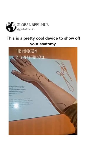 GLOBAL REEL HUB™ on Instagram: "Dm for Credit / Removal The post features a viral video of an interactive exhibit at Rijksmuseum Boerhaave in Leiden, Netherlands, where users place their arm on a table to trigger a projection overlaying veins, arteries, and simulated surgical tools for educational anatomy visualization. This device draws from 16th-century anatomist Andreas Vesalius's drawings in De Humani Corporis Fabrica, contrasting historical amputations for infections with modern non-invasiv