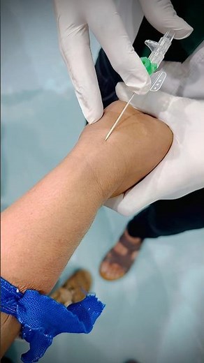 "Mastering the Technique: How to Insert a Large-Bore IV Cannula – Step-by-Step Guide"#educational