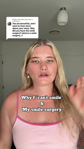 Unlocking the Power of My Unique Smile | Mobius Syndrome Journey