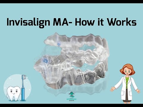 How Invisalign with MA Works