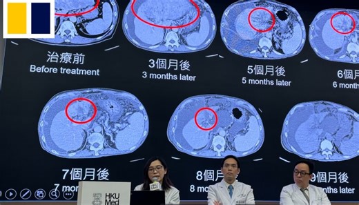 Cancer cure? Hong Kong develops ‘world’s first’ treatment to reverse stage-four liver cancer
