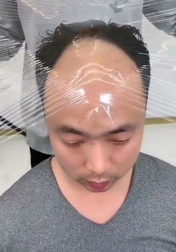 fix your bald patch easily 👍