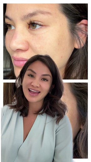 No7 Line Correcting Booster Serum Results After 2 Weeks