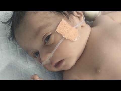 Ventilator support Birth Asphyxia baby Addmission in Nicu #pediatric #babyvideo #newbornbaby
