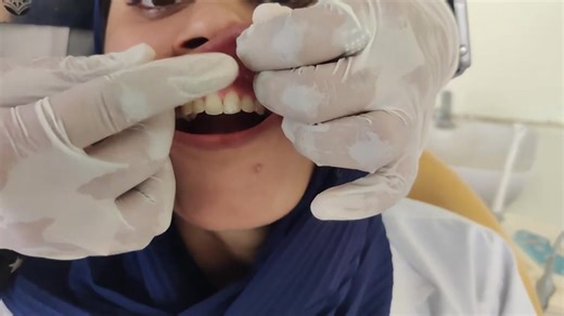 Demonstrating the Blanche Test for Midland Eistema