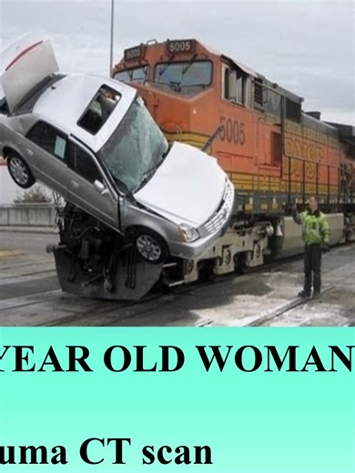 Professional   Educational Trauma CT scan 101 for med students and residents Learnhow to spot the key findings and save lives #MedTok #Trauma #fyp #radiology #medicalstudent