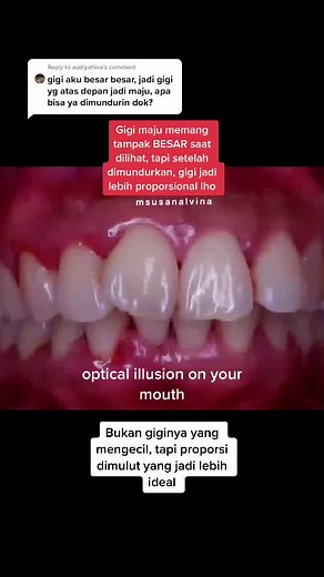 How to Fix Big Front Teeth: Optical Illusion in Mouth Part 1