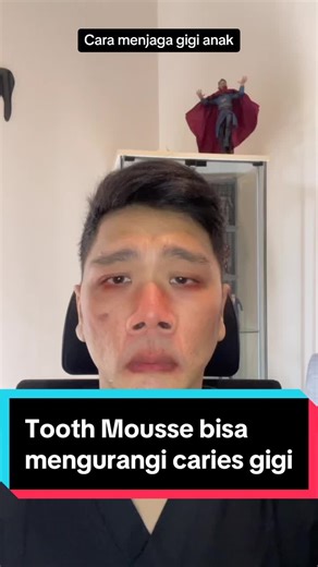 Manfaat Tooth Mousse untuk Mencegah Karies Gigi | Uncle Jo Dentist
