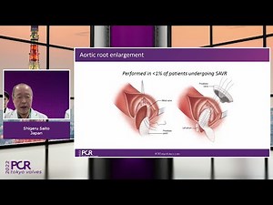 The importance of hemodynamic performance in transcatheter aortic valves - Webinar