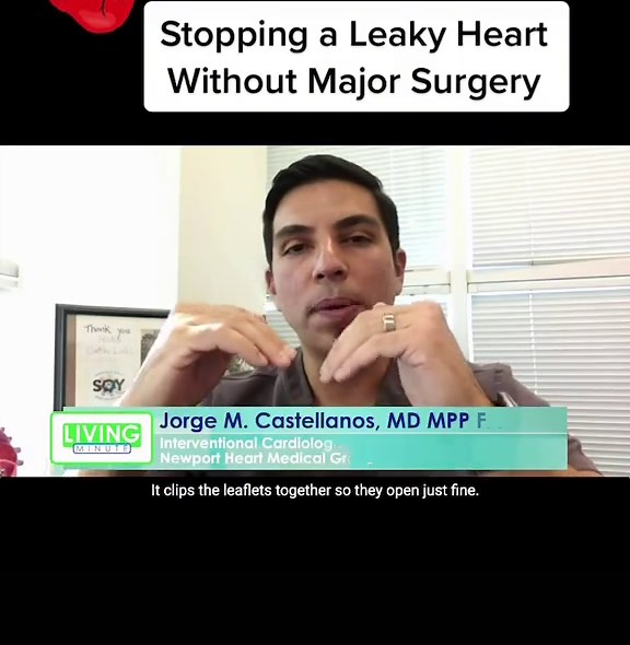 A minimally invasive procedure using a device called a Mitraclip is being used to repair a “leaky heart”. #heartsurgery #cardiology #leakyheart