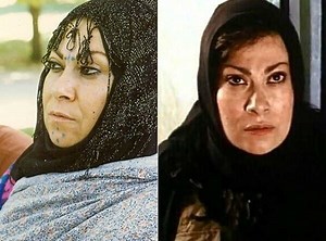 تغییر چهره شوکه کننده بازیگر معروف 72 ساله صداوسیما !