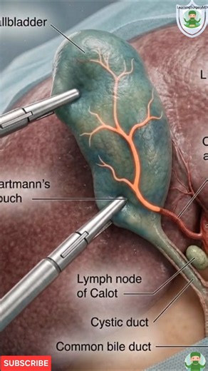 Laparoscopic Gallbladder Anatomy