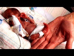 World's Smallest Baby Survives