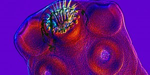 Is It A Parasite—Or Just A Stomach Bug? Here's How To Tell