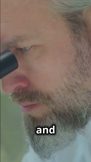 Wilson's Disease: Quick Diagnosis Guide!