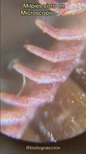 Millipede Feet Under a Microscope 🪱🔬🤯