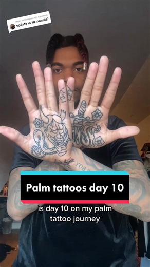 Healing Journey Update: Day 10 Palm Tattoos & Itchy Scabs