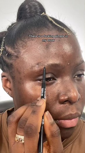 Eyebrow Pimple Popping: Dealing with Pesky Blemishes