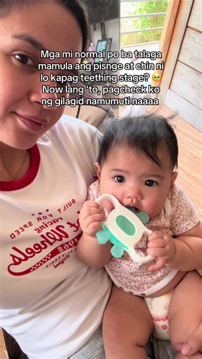 Understanding the Teething Stage for Babies