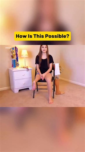 HiddenLogic on Instagram: "This Backward Foot Trick Will Blow Your Mind! A shocking surgery where doctors rotate the lower leg and attach the foot backwards so it works like a natural knee! This life-changing procedure helps patients walk, run, climb stairs, and even play sports again. Human body science is truly incredible. 🙌 #backwardfoot #legsurgery #medicalfacts #shorts #scienceexplained #amazingfacts #rotationsurgery #healthinfo #humanbody #unbelievable #reels #didyouknow #tranding #instar