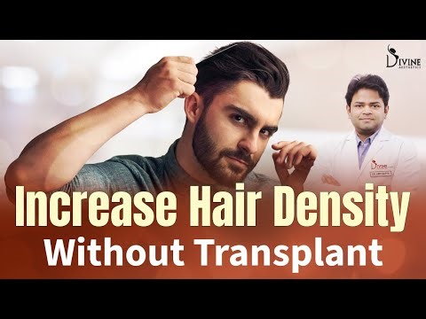 How to Increase Hair Density Without Hair Transplant | PRP, GFC, Vitamins & SVF | Dr Amit Gupta