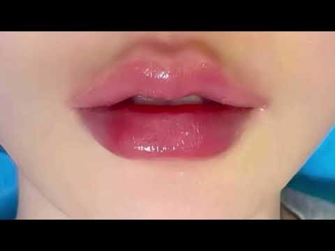 𝒽eart shaped lip lift ‹𝟹 💉