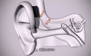 【2021北京国际听力学大会】 声佗携SoundBite/品音牙骨传导听力系统亮相2021北京国际听力学大会会，欢迎参与体验